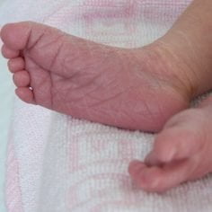 Skóra stóp u osób z otyłością