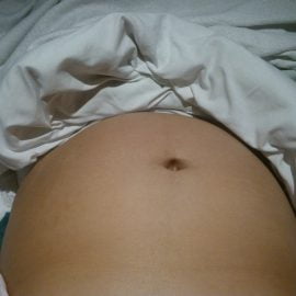 Niedobór żelaza w ciąży