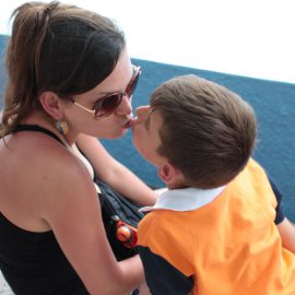 Przebarwienia skóry w ciąży