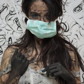 przeciwciała toksoplazmozy